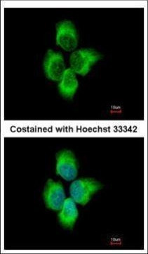 MMP8 Antibody in Immunocytochemistry (ICC/IF)