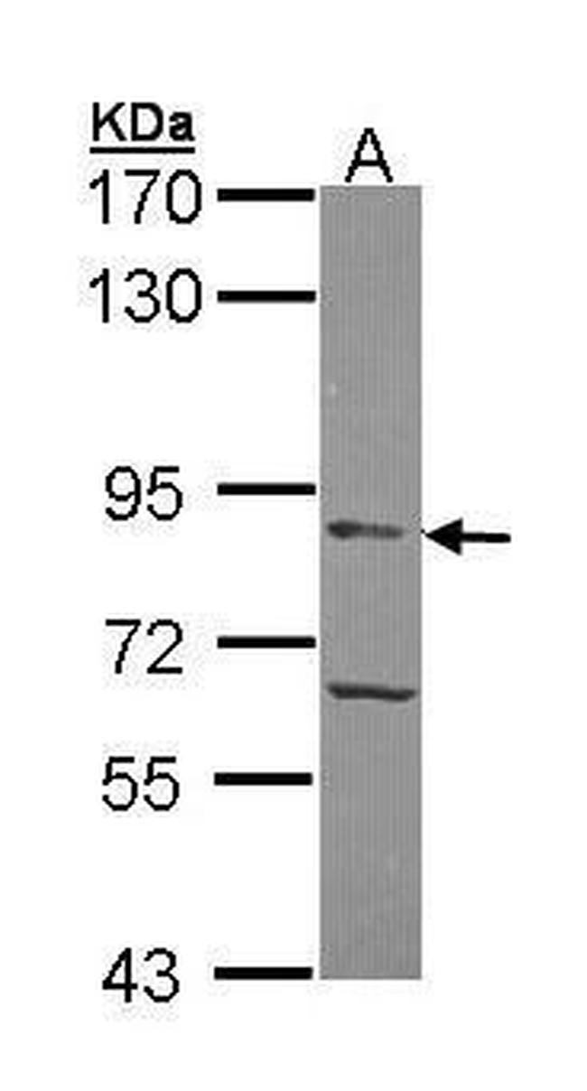 APEH Antibody in Western Blot (WB)