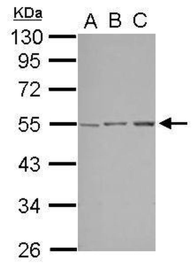 STK38L Antibody in Western Blot (WB)