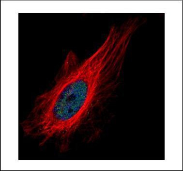 ZNF449 Antibody in Immunocytochemistry (ICC/IF)