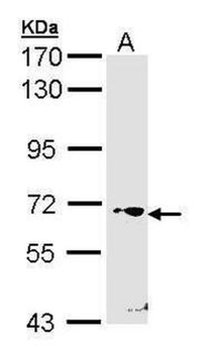 RORC Antibody in Western Blot (WB)