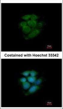JNK2 Antibody in Immunocytochemistry (ICC/IF)