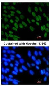 ZMYM2 Antibody in Immunocytochemistry (ICC/IF)