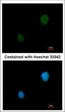 PRKAR2B Antibody in Immunocytochemistry (ICC/IF)