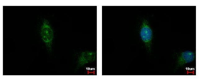 CSNK1A1L Antibody in Immunocytochemistry (ICC/IF)