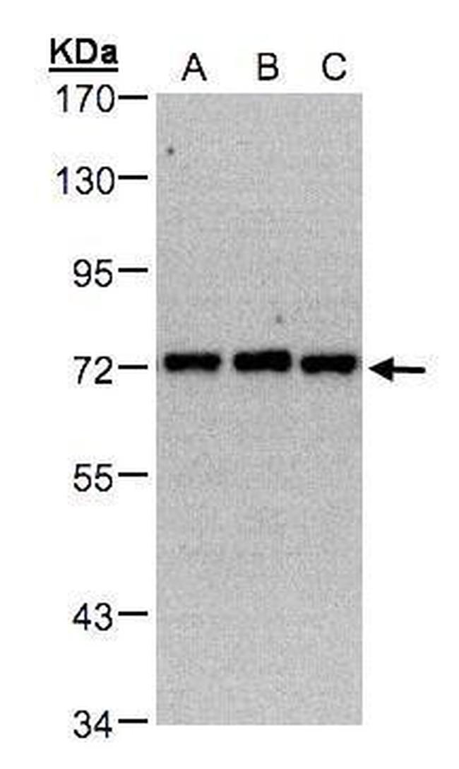 PIP5K1C Antibody in Western Blot (WB)