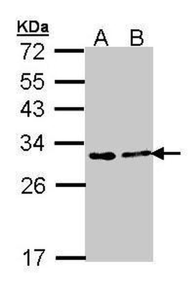 FKBP25 Antibody in Western Blot (WB)