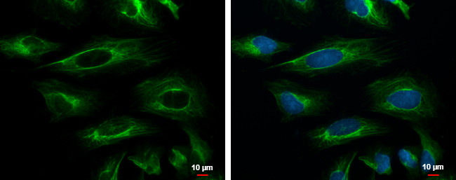 Cytokeratin 18 Antibody in Immunocytochemistry (ICC/IF)