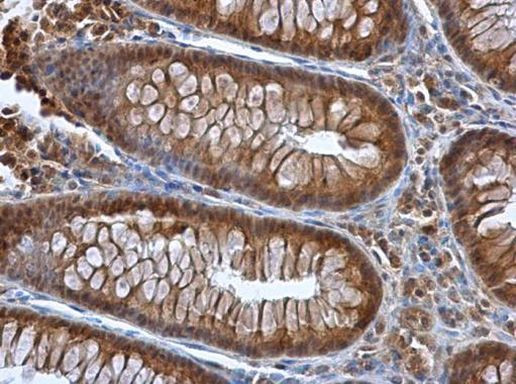 SEPP1 Antibody in Immunohistochemistry (Paraffin) (IHC (P))