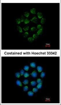 Cathepsin O Antibody in Immunocytochemistry (ICC/IF)