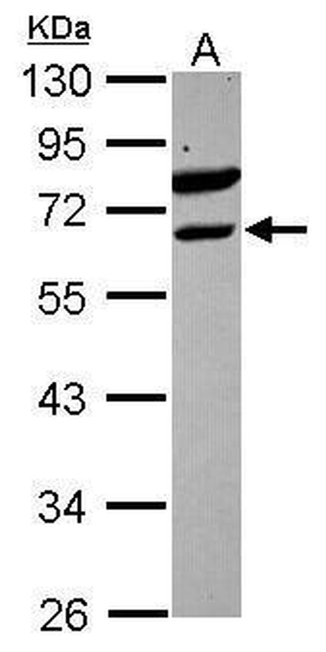 ETV6 Antibody in Western Blot (WB)