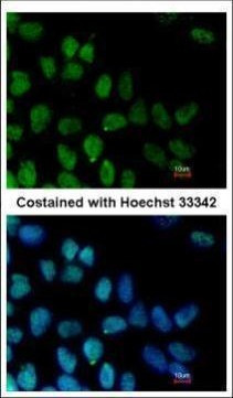 ZNF281 Antibody in Immunocytochemistry (ICC/IF)