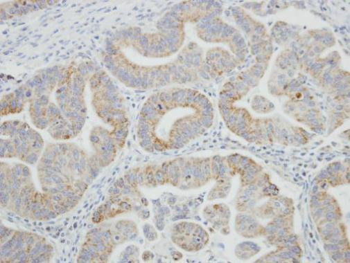 SRPR Antibody in Immunohistochemistry (Paraffin) (IHC (P))