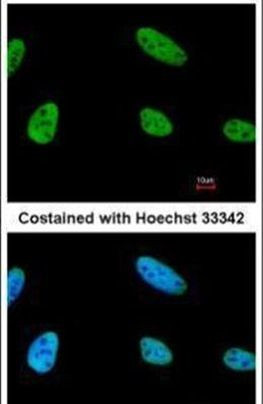 NPAS2 Antibody in Immunocytochemistry (ICC/IF)