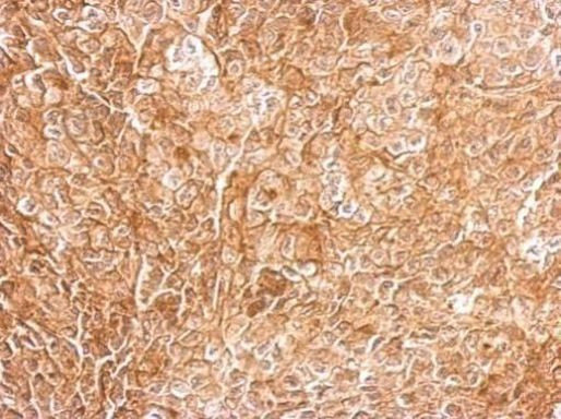 CHL1 Antibody in Immunohistochemistry (Paraffin) (IHC (P))