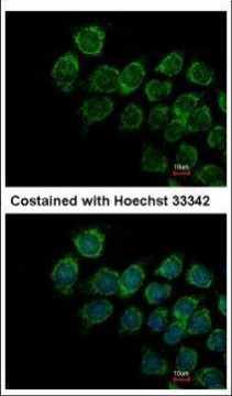 IFNAR2 Antibody in Immunocytochemistry (ICC/IF)
