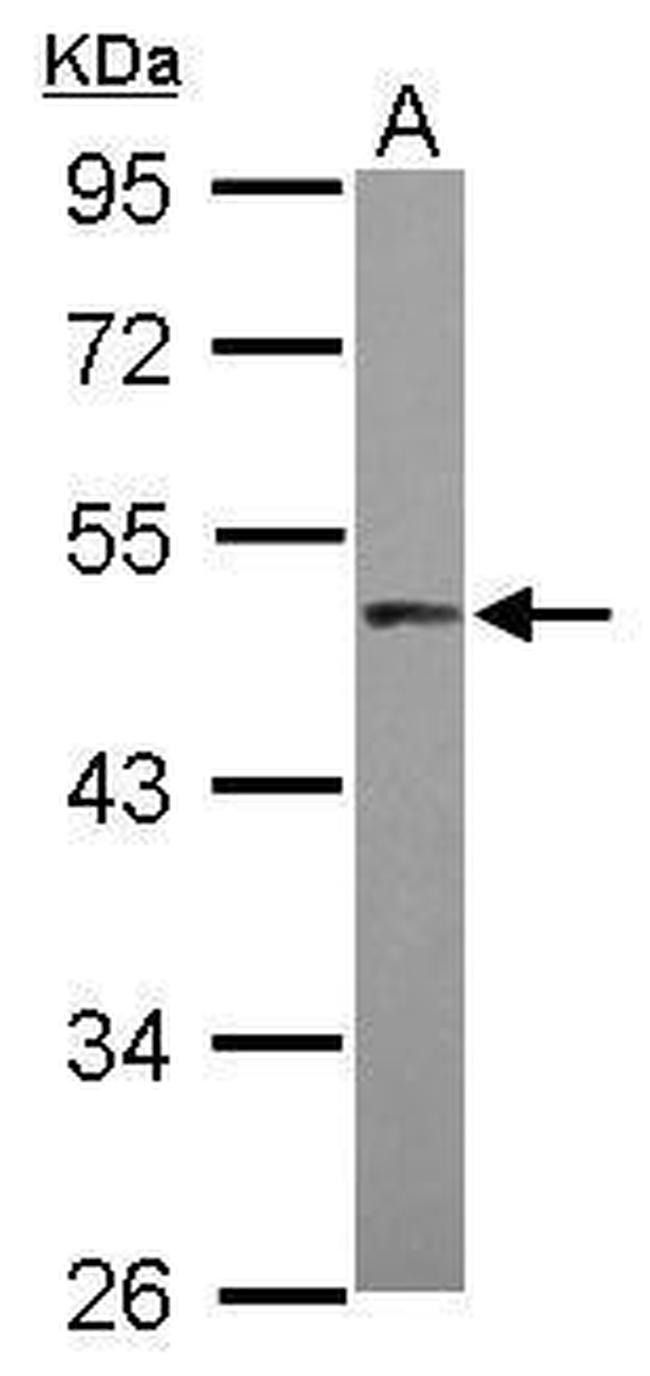 PRAK Antibody in Western Blot (WB)