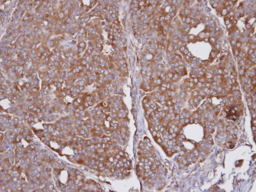 SEC31A Antibody in Immunohistochemistry (Paraffin) (IHC (P))