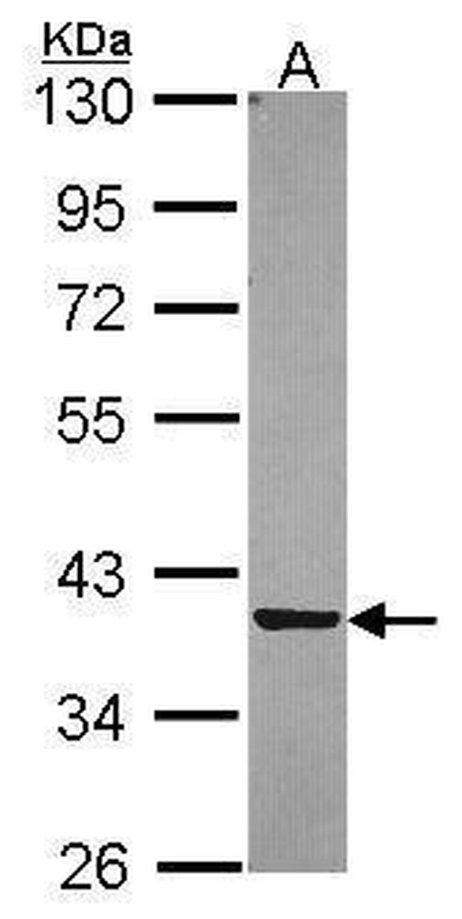 PIG3 Antibody in Western Blot (WB)