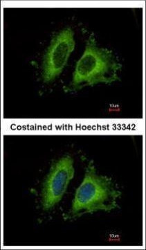 GIT1 Antibody in Immunocytochemistry (ICC/IF)