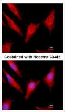 Protein C Antibody in Immunocytochemistry (ICC/IF)