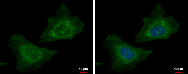 RABGGTB Antibody in Immunocytochemistry (ICC/IF)
