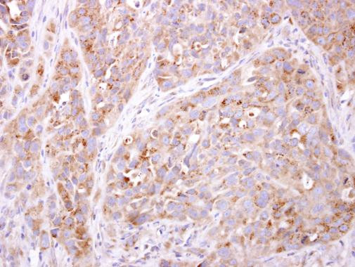 ETNK1 Antibody in Immunohistochemistry (Paraffin) (IHC (P))