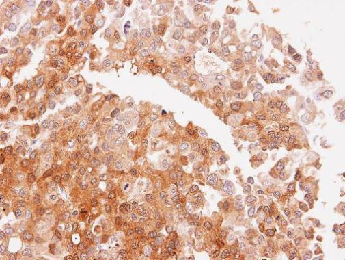 NQO2 Antibody in Immunohistochemistry (Paraffin) (IHC (P))