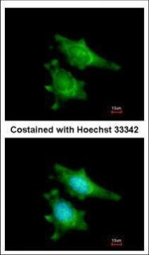 RIP2 Antibody in Immunocytochemistry (ICC/IF)