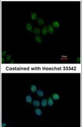 HDAC7 Antibody in Immunocytochemistry (ICC/IF)