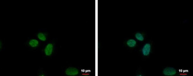 UBP1 Antibody in Immunocytochemistry (ICC/IF)