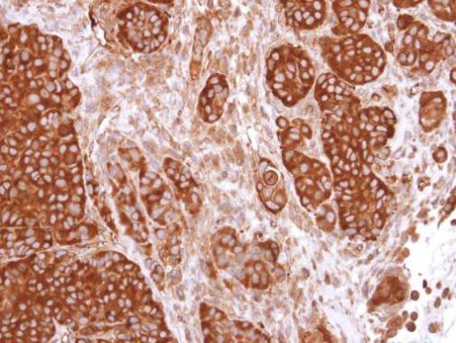 CaMKIV Antibody in Immunohistochemistry (Paraffin) (IHC (P))