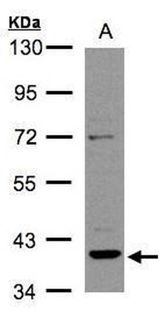 RAD51B Antibody in Western Blot (WB)
