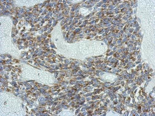 KCNG4 Antibody in Immunohistochemistry (Paraffin) (IHC (P))