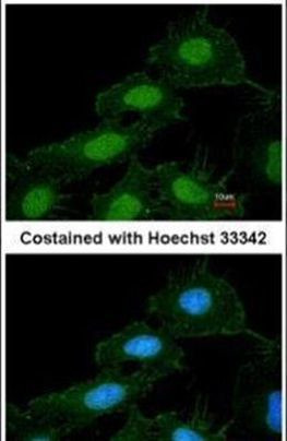 CaMKI Antibody in Immunocytochemistry (ICC/IF)