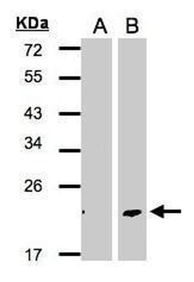 DPT Antibody in Western Blot (WB)