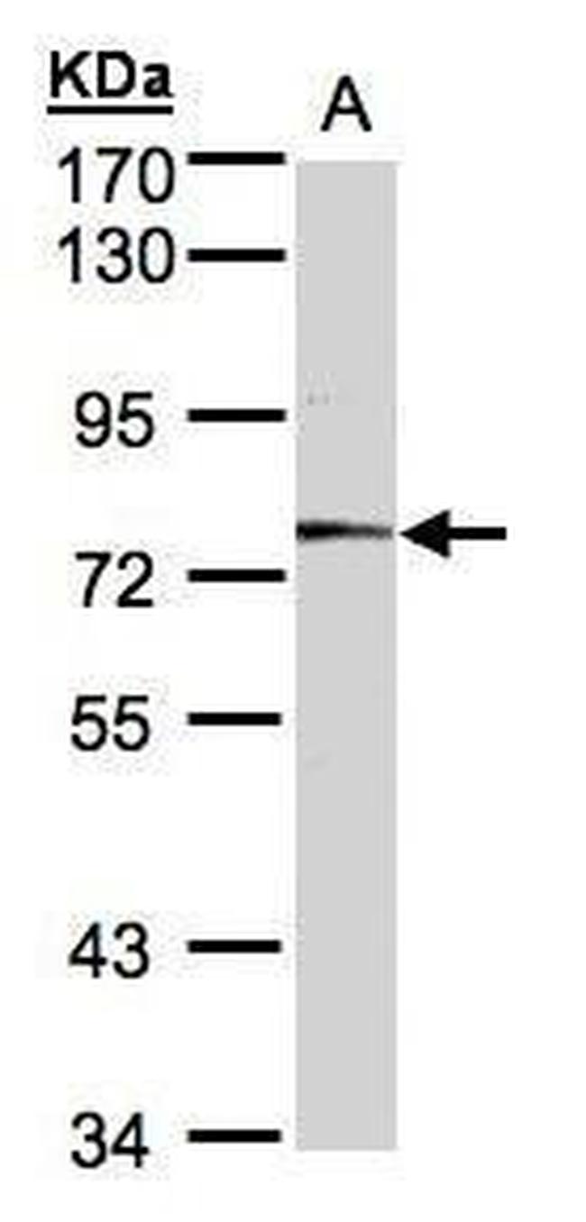 MEP1A Antibody in Western Blot (WB)
