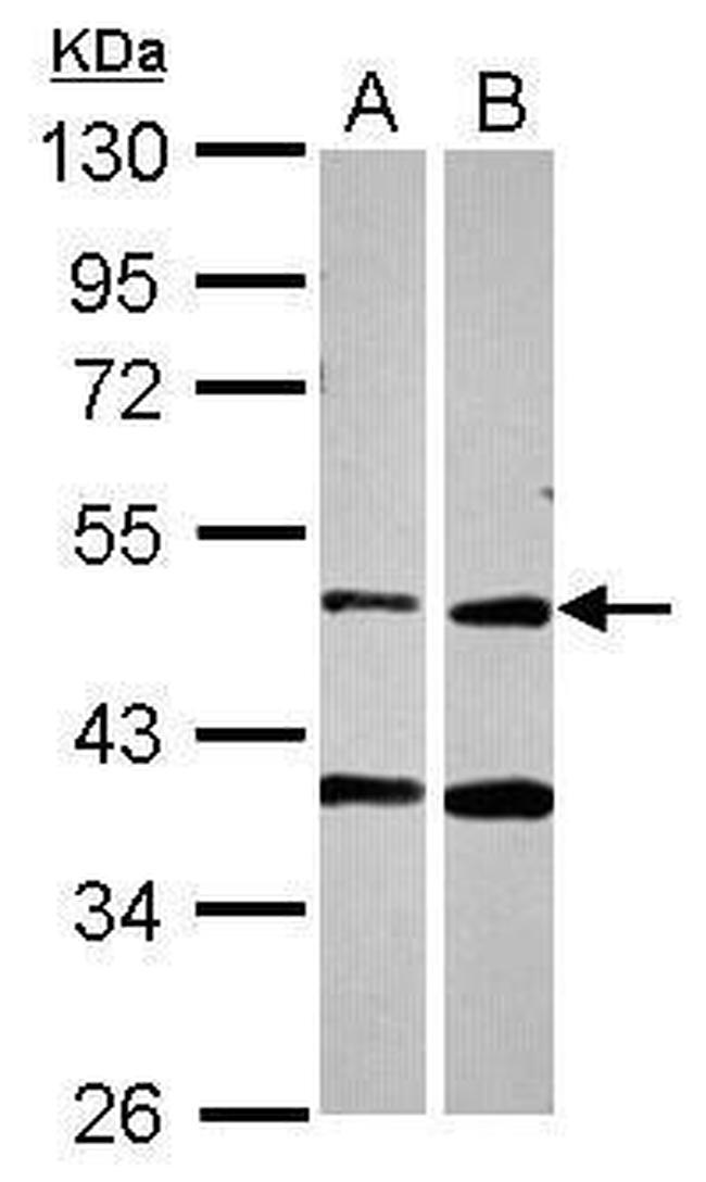 PPOX Antibody in Western Blot (WB)