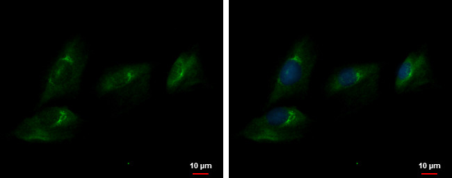 ENPP2 Antibody in Immunocytochemistry (ICC/IF)