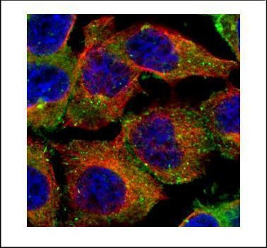 CD2AP Antibody in Immunocytochemistry (ICC/IF)