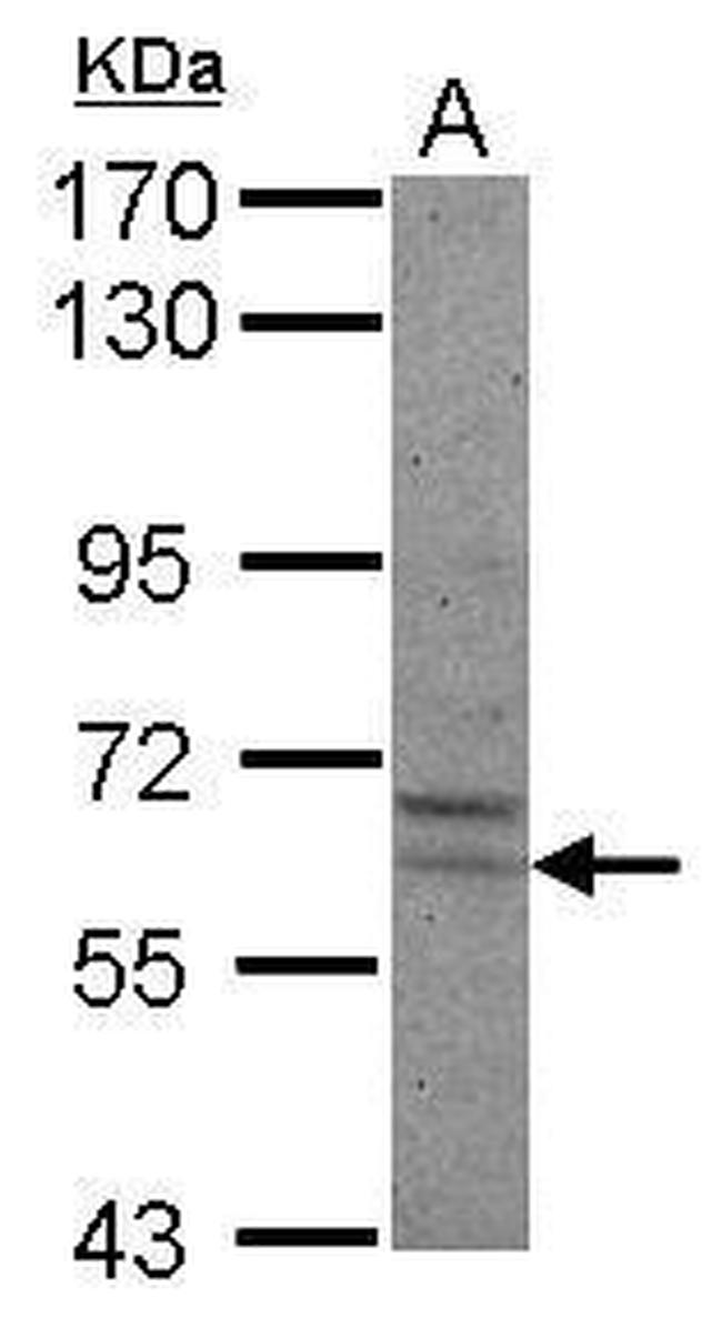 PRAME Antibody in Western Blot (WB)