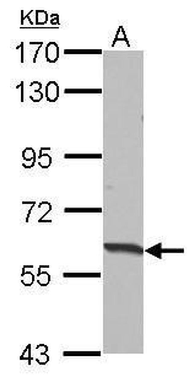 HABP2 Antibody in Western Blot (WB)