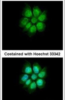 MEFV Antibody in Immunocytochemistry (ICC/IF)