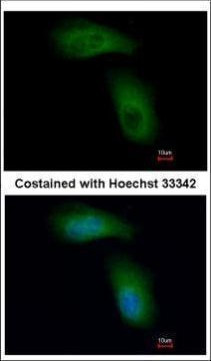 TRIM36 Antibody in Immunocytochemistry (ICC/IF)