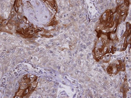 SIL1 Antibody in Immunohistochemistry (Paraffin) (IHC (P))