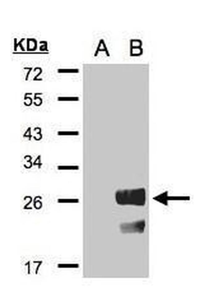 RGS19 Antibody in Western Blot (WB)