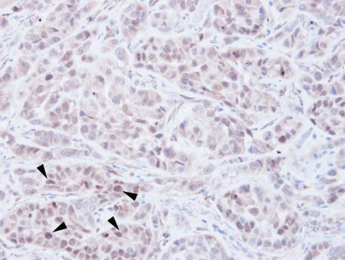 NSD2 Antibody in Immunohistochemistry (Paraffin) (IHC (P))