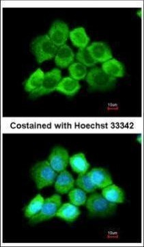 CENTG3 Antibody in Immunocytochemistry (ICC/IF)