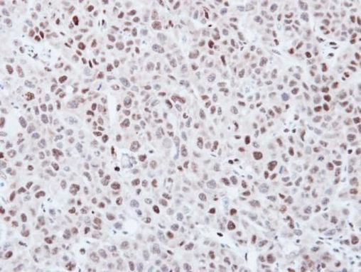 KPNA3 Antibody in Immunohistochemistry (Paraffin) (IHC (P))