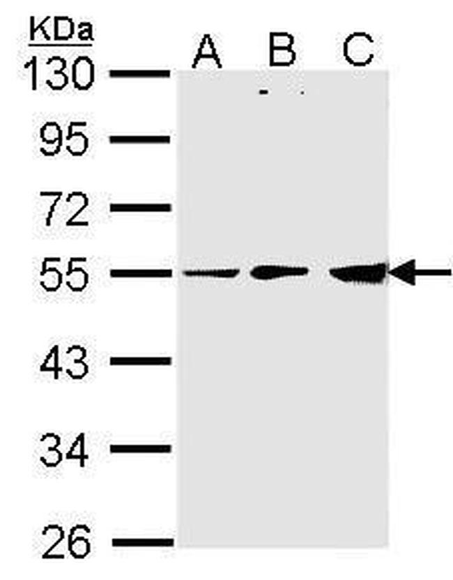 PDHX Antibody in Western Blot (WB)